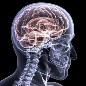 Brain injury caused by a car accident